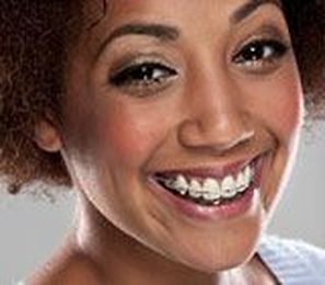 Teeth Straightening: It's Not Just For Kids |