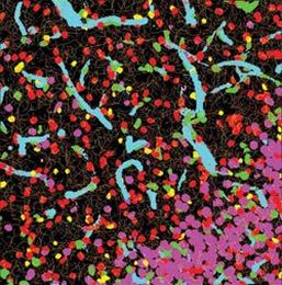 Helping Pathologists Use New Technology to Identify and Classify Cancer-Related Cells