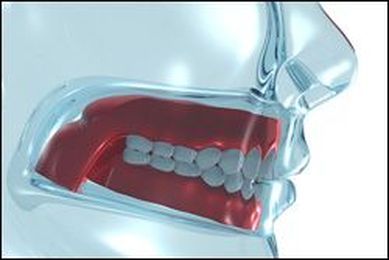 Dentures: Restoring Your Smile for a More Confident You