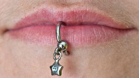 When Body Piercings Go Bad
