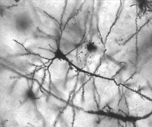 What does chronic stress in adolescence mean at the molecular level?