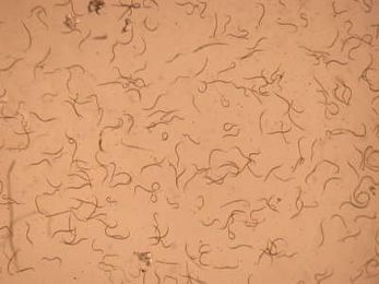 How to Begin Beneficial Nematode Applications