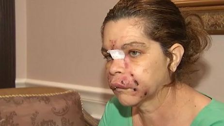 Spa Cosmetic Procedures Can Be Risky