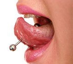 Oral Piercings &mdash; Tongue &amp; Lip Bolts: Trendy But Dangerous