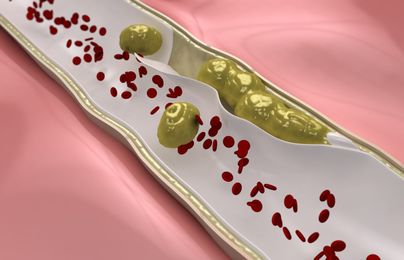 A New Way to Raise ‘Good’ Cholesterol?