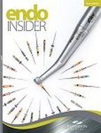 Challenges of Root Canal Preparation