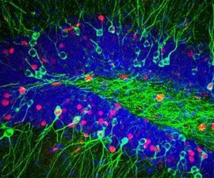 The neuroscience of finding your lost keys