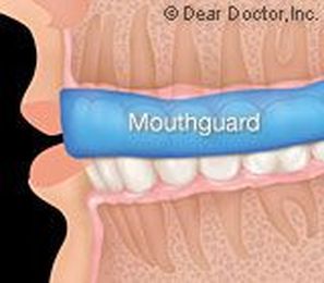 The Value of Mouthguards