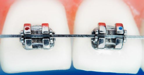 What to expect at an adjustment appointment