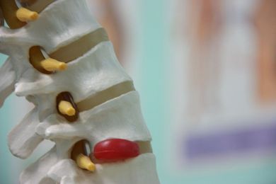 Back Pain Myths: Posture, Core Strength, Bulging Discs