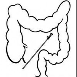 Why should you choose a colorectal surgeon?