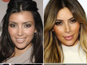 Kim Kardashian: Has She Had Plastic Surgery? — Doctors Speak Out