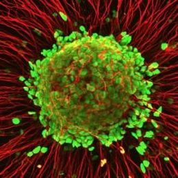 The origin of Lou Gehrig's disease may have just been discovered