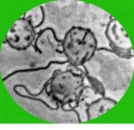 What We Know About Morgellons