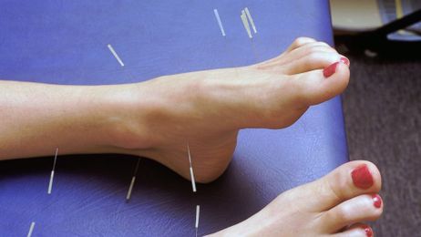 A Close-up Look at Acupuncture for Pain