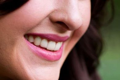 Dental Bonding Is An Economical Solution For Beautiful Teeth