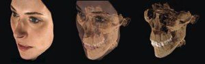 3D Dentistry:  Amazing Technology for our Patients