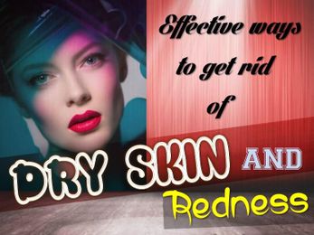 Effective Ways to Get Rid of Dry Skin and Redness