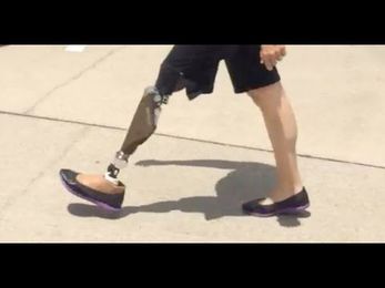 New Prosthetic Foot from TaiLor Made For You!