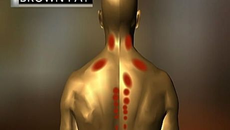 Healthy "brown fat" may reduce risk for obesity and diabetes