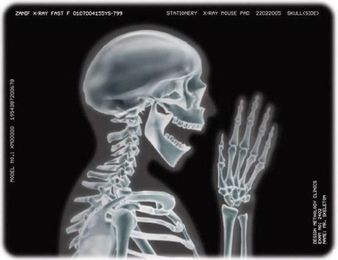 Are X-rays Really Necessary?