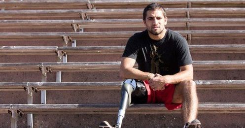 Forget Cheetah Blades. This Prosthetic Socket Is a Real Breakthrough