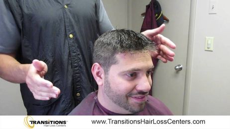 Non-Surgical Hair Replacement Challenge
