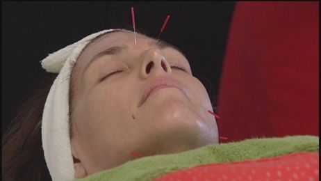 Fight fine lines and wrinkles with acupuncture