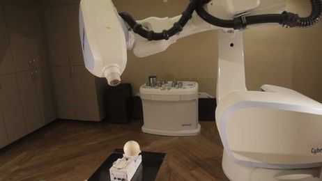 Radiosurgery: What is CyberKnife Robotic RadioSurgery?