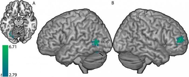 Concentrating on word sounds helps reading instruction and intervention