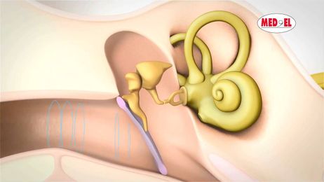 Video Describing the Process of Hearing and How it Works