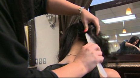 How common is hair loss in women?