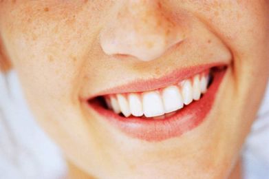 Supreme Court Says Dentists Can't Decide Who Gets to Whiten Your Teeth