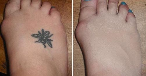 Tips For Hiding A Tattoo