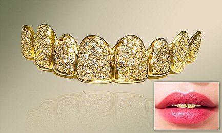 Dentist crafts dentures from gold and diamonds that are worth £89,000