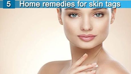 5 home remedies for skin tags on face and neck