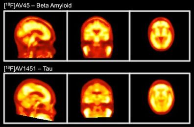 Can Kinect technology improve brain imaging?
