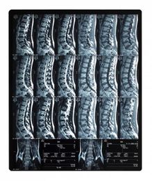 The True Meaning of Physical Therapy: You Are Not Your MRI