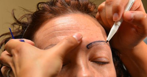 Transplantation one route to fuller eyebrows
