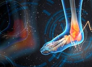 Don’t Take Sprain Recovery for Granted