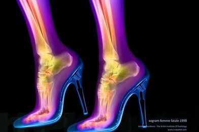 14 Fascinating X-Rays That Will Change The Way You Look At The Human Body