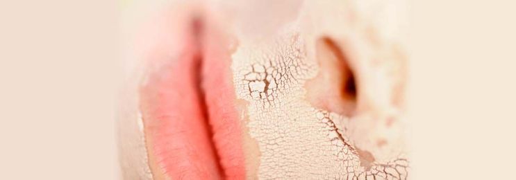 The Common Causes Of a Dry Mouth