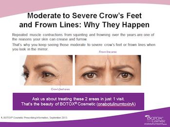 Take a Closer Look at BOTOX Cosmetic