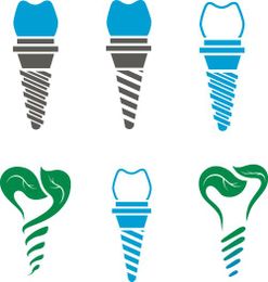 Dental Implants: Learning the Basics