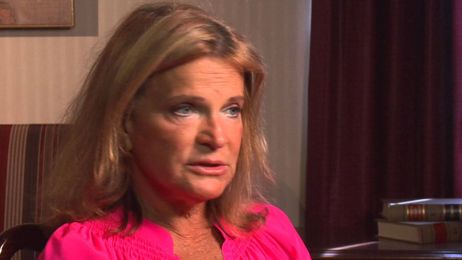 I Regained My Youthful Cheek Bones after a Mini Facelift