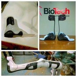 Prosthetic and Orthotic Carbon Fiber Technology