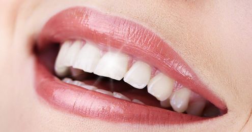 Six Frequently Asked Questions About Cosmetic Dentistry 