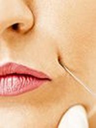 The New, FDA-Approved Way to Plump Your Cheeks