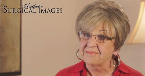 Meet Our Patients: Connie on Regaining Your Youth