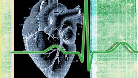 When To Start Taking A Cholesterol Pill? The Decision Is Yours